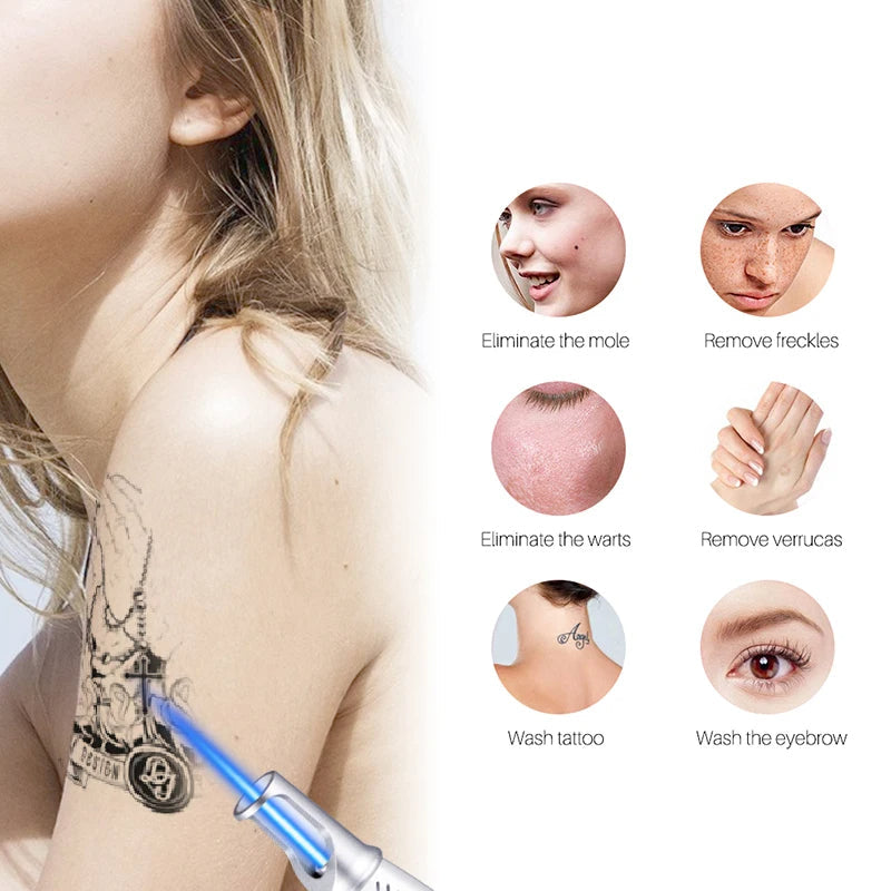 Smart Tattoo Removal Laser Pen - Ta bort födelsemärken, fräknar, akne, tatuering Carvallo